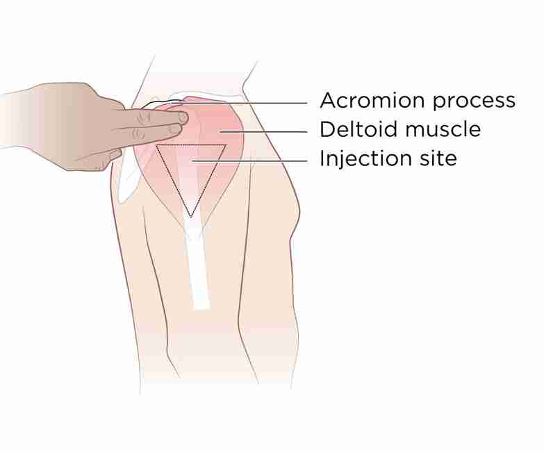 injection-medicine-wikidoc