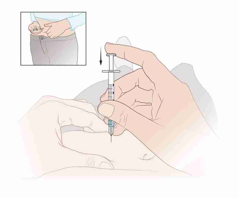 How-to subcutaneous